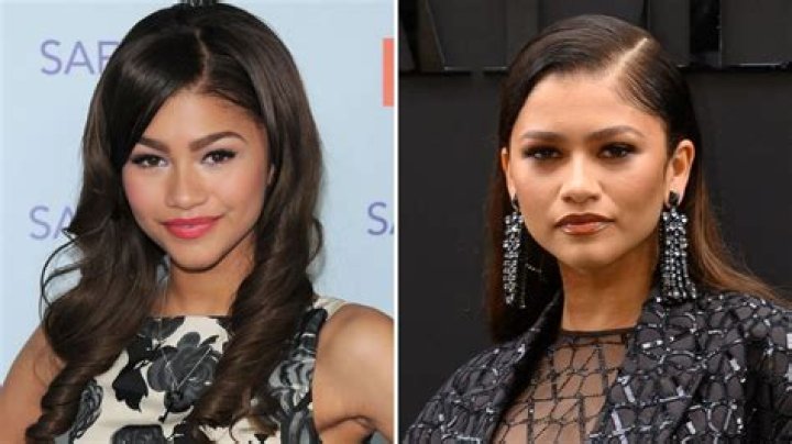 Unveiling Zendaya's Plastic Surgery: Insights And Discoveries